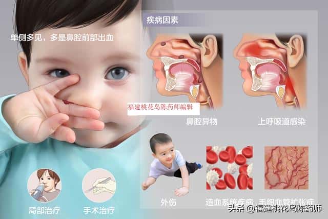 小孩流鼻血是什么原因怎么治疗（小孩流鼻血是怎么回事怎么治疗）